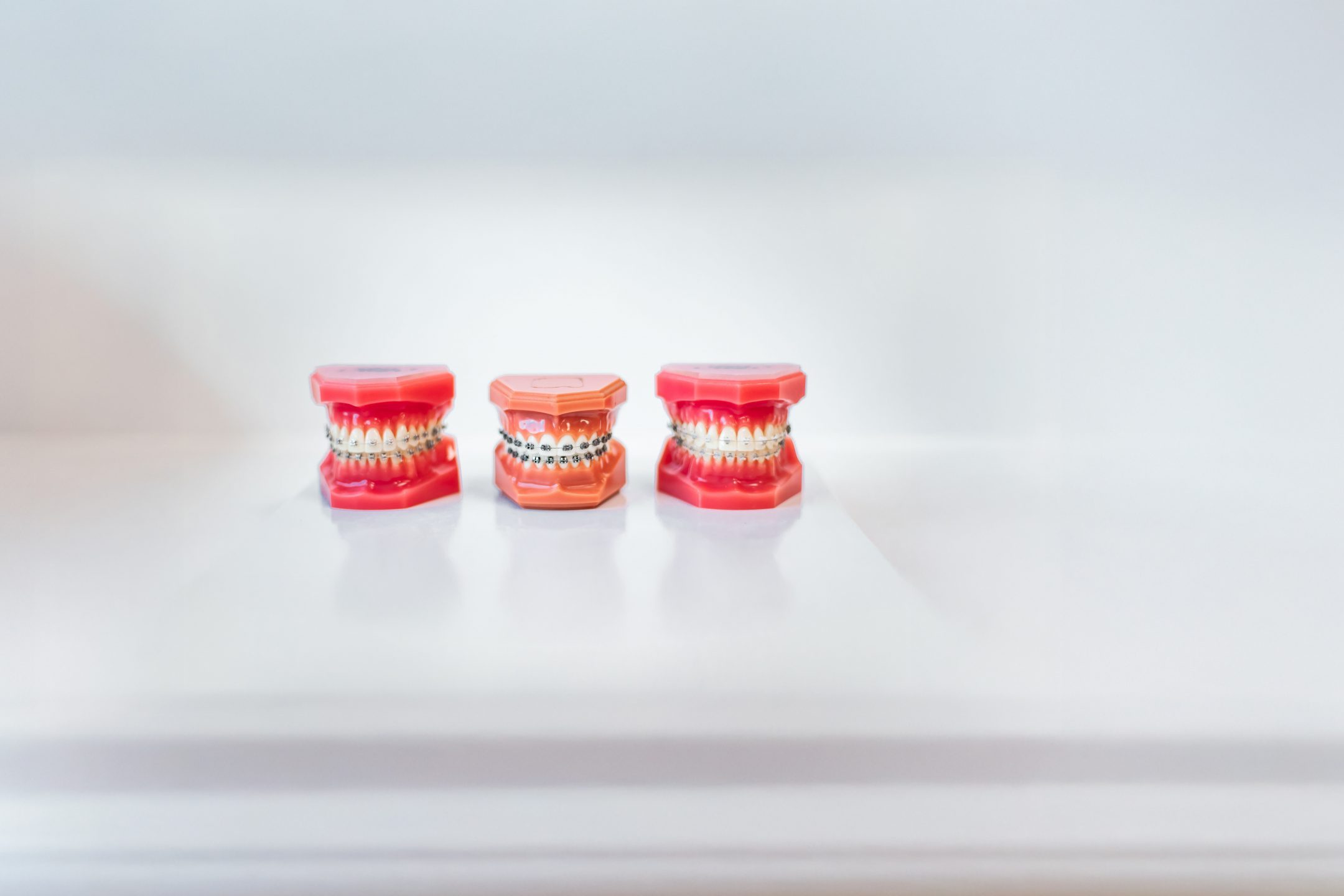 Metallbrackets und transparente Brackets, Kieferorthopädie Wiesbaden-Nordenstadt, Dr. Annika Wagner & Dr. Claudia Neumann